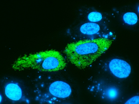 Expresión de la proteína retinosquisina (verde) tras la transfección de una línea celular de epitelio pigmentario de retina (ARPE-19) con una formulación a base de nanopartículas lipídicas con el gen RS1. En azul, los núcleos de las células. (Autor: grupo Farmacocinética, Nanotecnología y Terapia Génica)