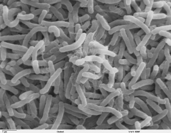 Vibrio cholerae: la bacteria que causa el cólera 