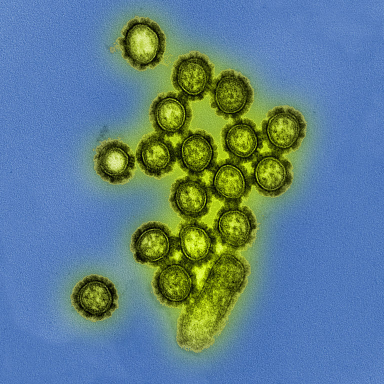H1N1_virus_particles