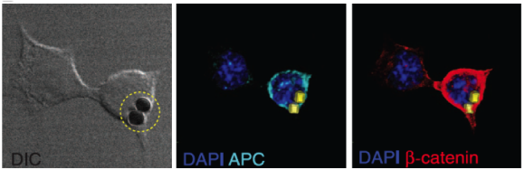 Figura 4: Imágenes de microscopía de una célula madre embrionaria terminando su división. A la izquierda (DIC) se puede observar la célula vista a través del microscopio y que tiene unidas dos nanopartículas con Wnt3a. Las otras dos imágenes de fluorescencia de la misma célula muestran componentes involucrados en la recepción y transducción de Wnt3a (APC y b-catenin) que se acumulan solo en el polo donde se encuentran las nanopartículas (amarillo) y por tanto serán heredadas por la célula hija que acabe en dicho polo. El ADN se muestra en azul oscuro (DAPI) Fuente: [2].