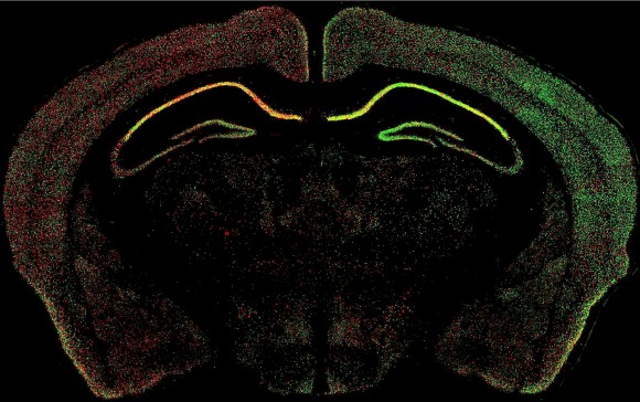 Patrón de expresión de izquierda a derecha del cromosoma X en el cerebro de un ratón hembra. Imagen: Hao Wu y Jeremy Nathans (Cell press)