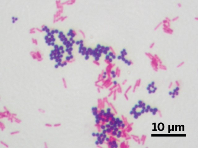 20150428lnp1-gramstain