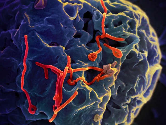 Micrografía electrónica del virus del ébola sobre una célula de cultivo / NIAID-Wikimedia