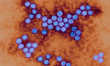 Imagen de poliovirus por microscopía electrónica de transmisión.
