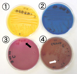 Diferenciación de bacterias por cultivo