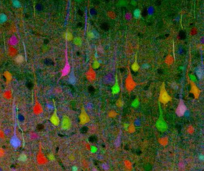 Imagen 2. Neuronas de ratón. Pablo Barrecheguren