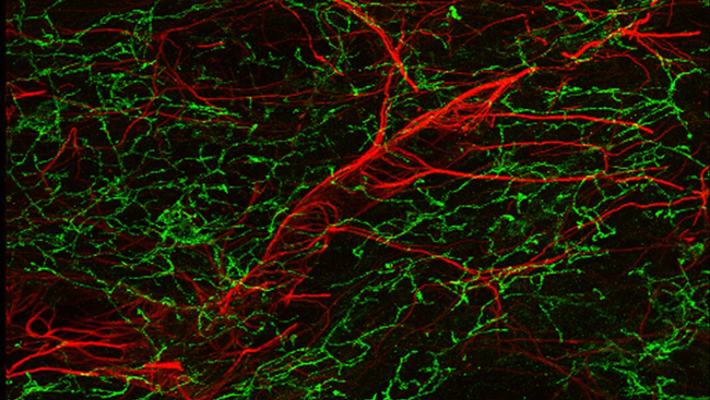 Mouse_Blood_Brain_Barrier