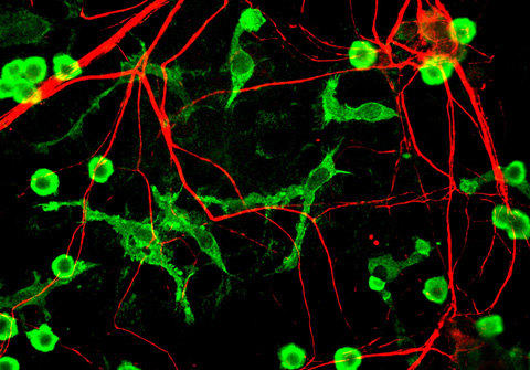 La hiperactividad neuronal impide que las microglías realicen su trabajo