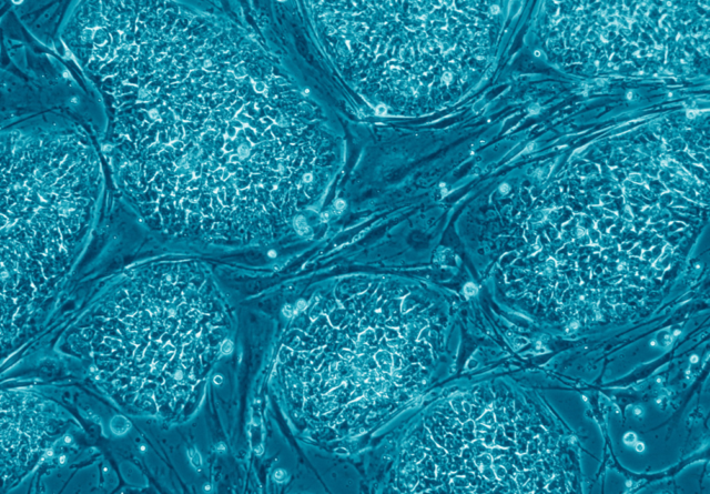 human_embryonic_stem_cells_only_a
