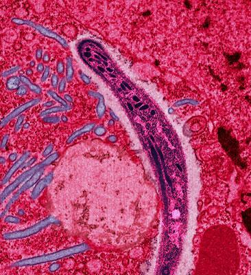 "Plasmodium" en el interior de una célula en la saliva de un mosquito hembra.