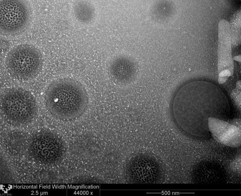 El papel de las nanopartículas lipídicas en terapia génica