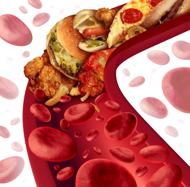 colesterol-sangre