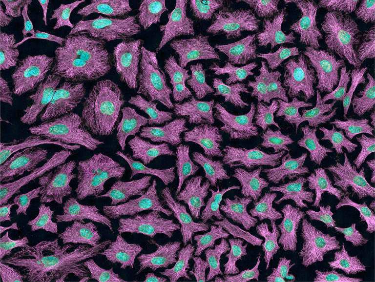1-HeLa-cells-stained-pink-public-domain