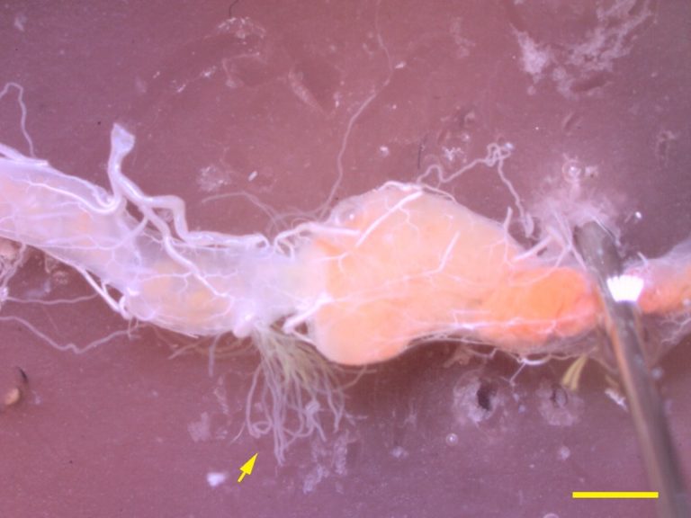 Malphigian_tubules_of_a_dissected_cockroach.tif
