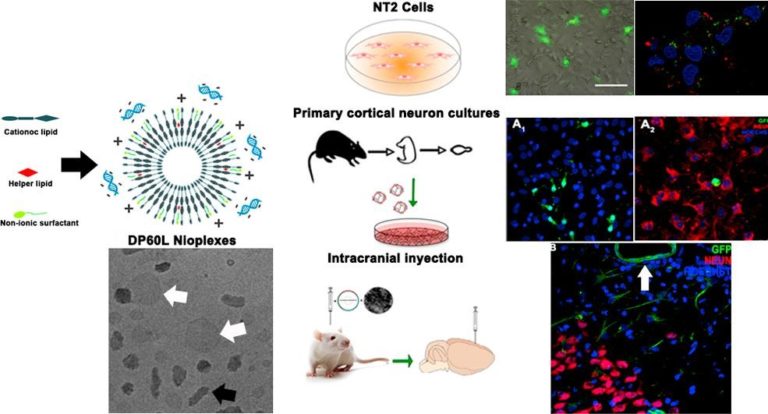 Niosomas como vectores de terapia génica del sistema nervioso central