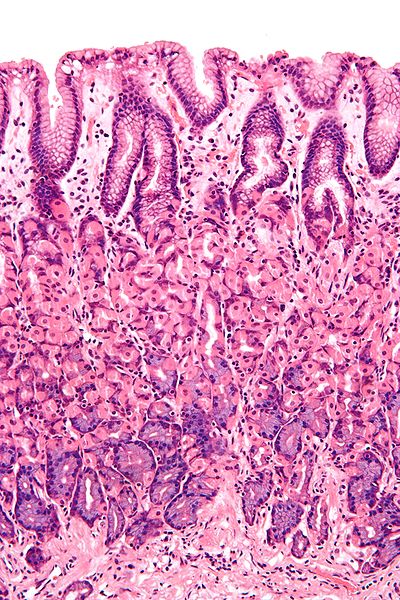 400px-Normal_gastric_mucosa_intermed_mag