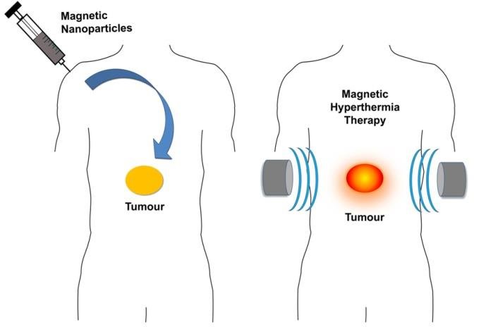 Nanopartículas recubiertas para el tratamiento localizado del cáncer por hipertermia magnética
