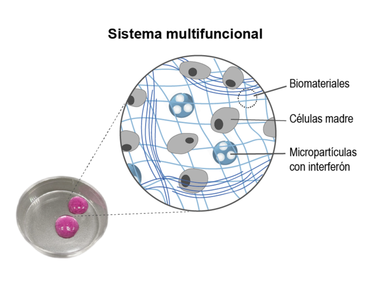 Células madre para el tratamiento de la enfermedad inflamatoria intestinal
