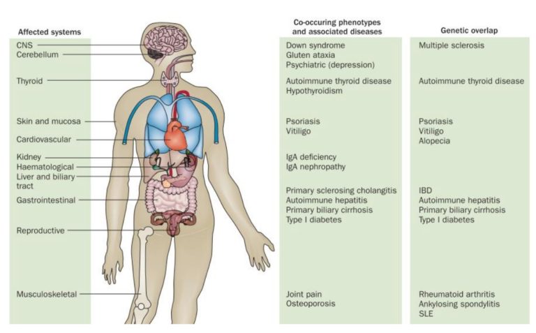 La base genética de la autoinmunidad: enfermedad celíaca y diabetes mellitus tipo I.