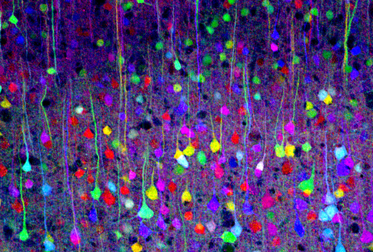 La asombrosa variedad genética de las neuronas humanas
