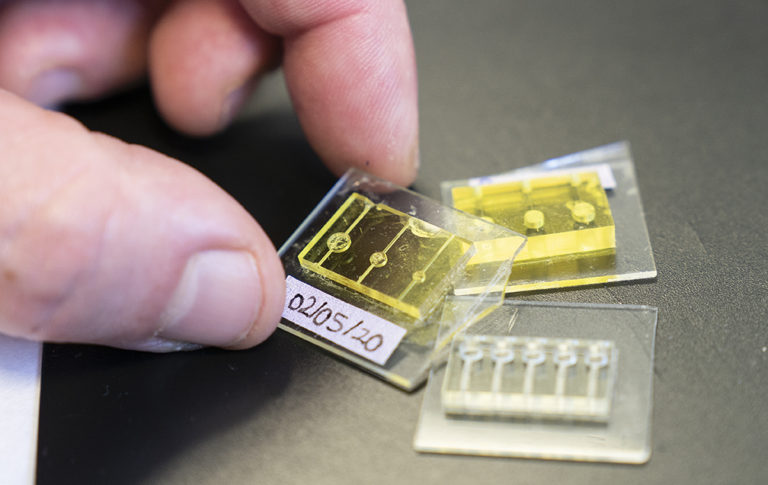 Dispositivos microfluídicos de separación de plasma por impresión 3D
