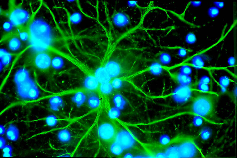 Estas células generan electricidad en el encéfalo. No son neuronas.