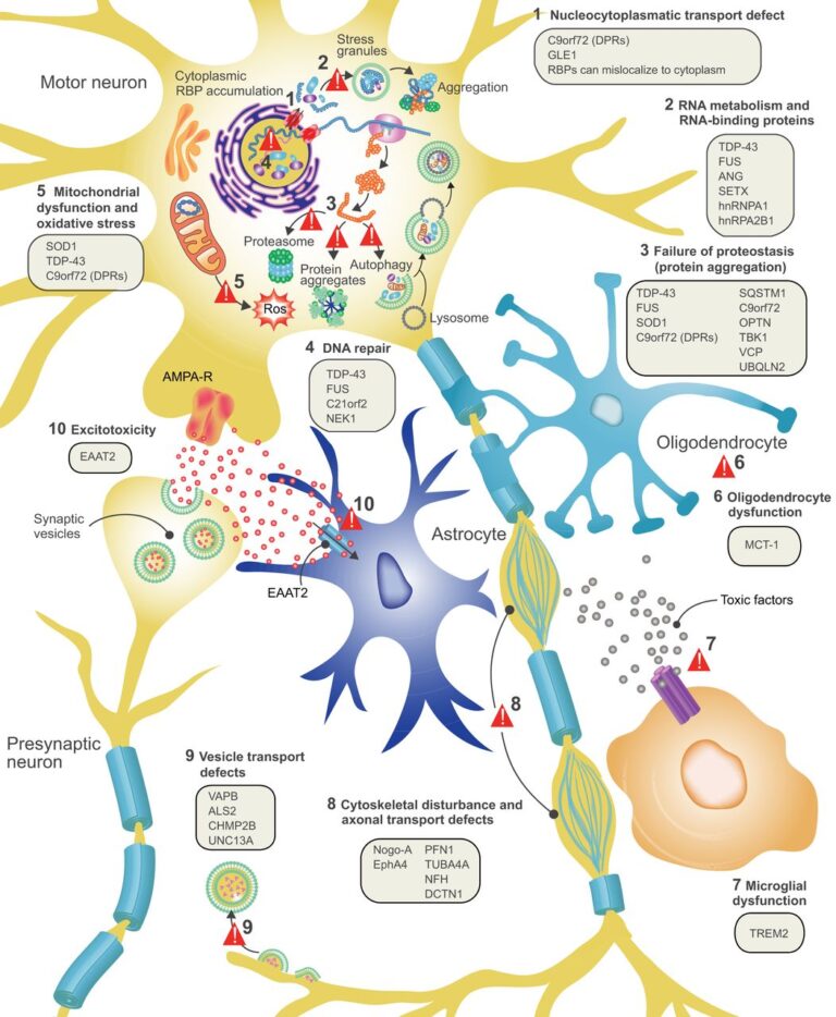 Posible estrategia terapéutica contra la esclerosis lateral amiotrófica
