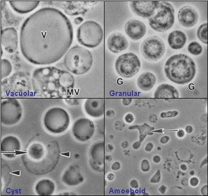 Blastocystis