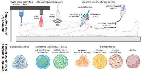 La bioimpresión 3D en la medicina regenerativa