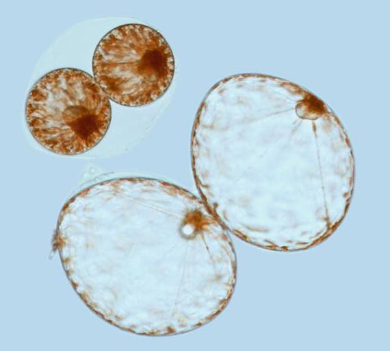 Pyrocystis