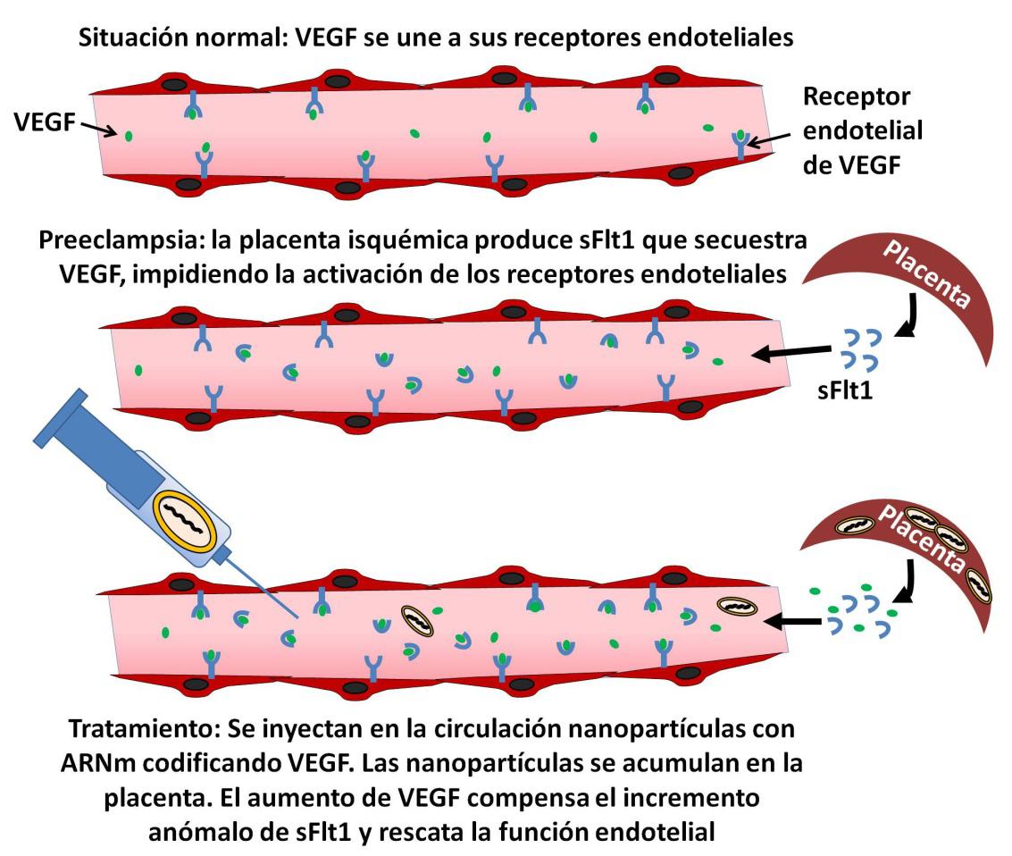 preeclampsia