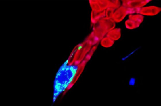 Las células cancerosas obtienen energía robando mitocondrias de los nervios