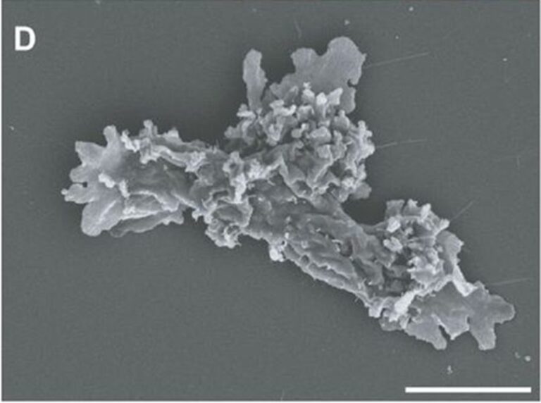 Una nueva especie de ameba bate el récord de resistencia al calor