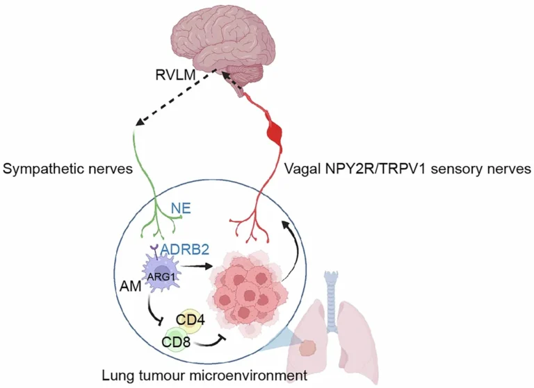 Los tumores pulmonares debilitan la inmunidad usando el encéfalo