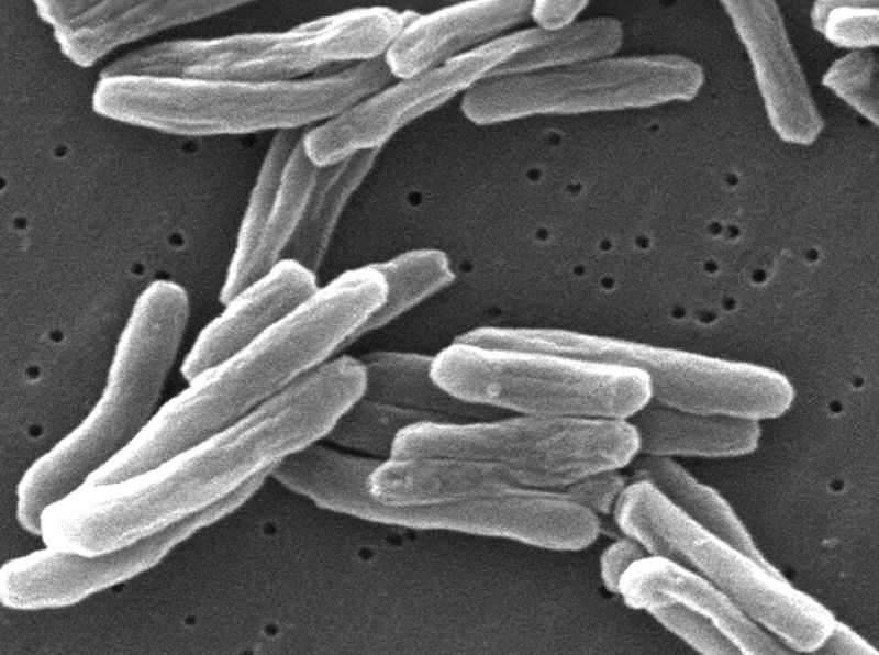 tuberculosis